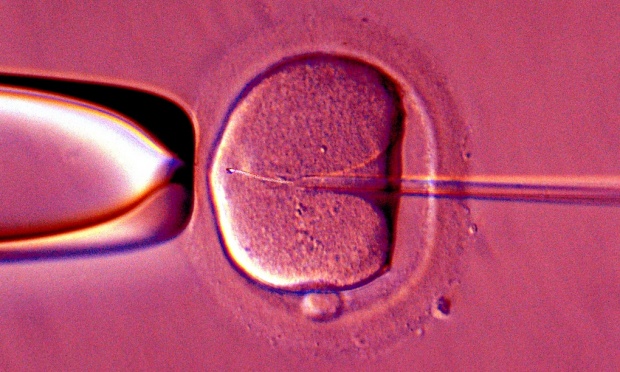 IVF-artificial-inseminati-008
